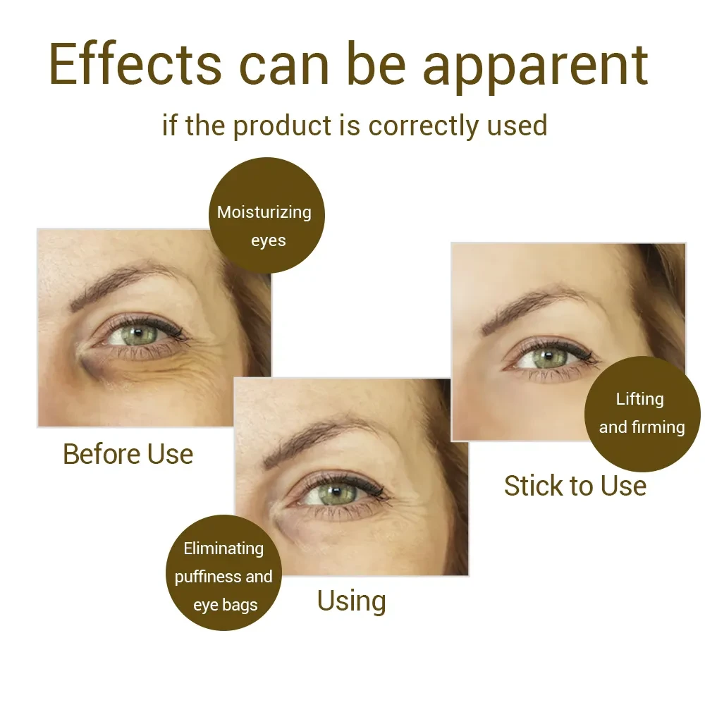Crema de masaje eléctrico para ojos para aclarar las ojeras