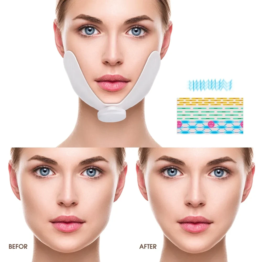 Masajeador facial adelgazante para mujeres, dispositivo de lifting facial en forma de V