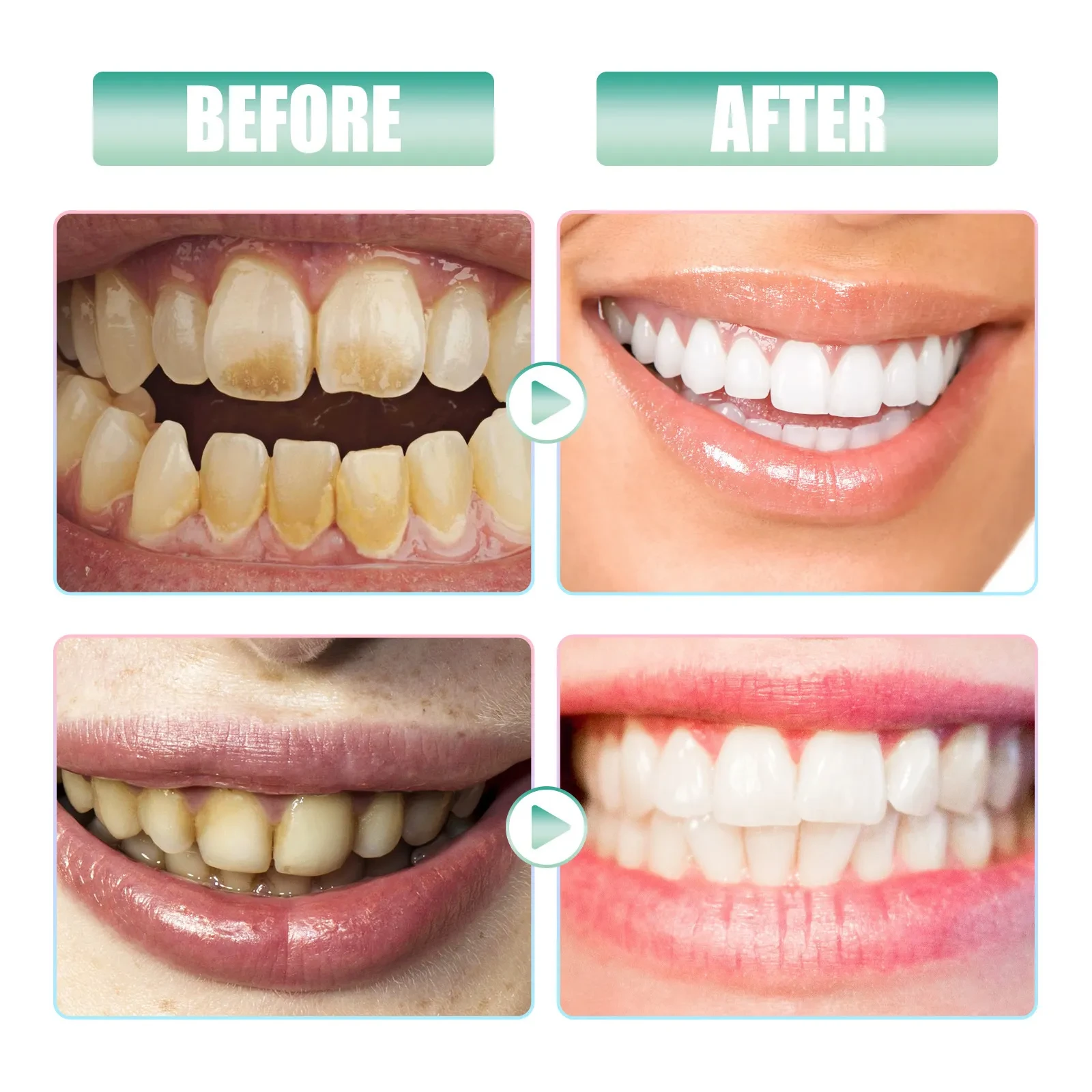 Pasta dental blanqueadora con nicotinamida, cuidado limpiador