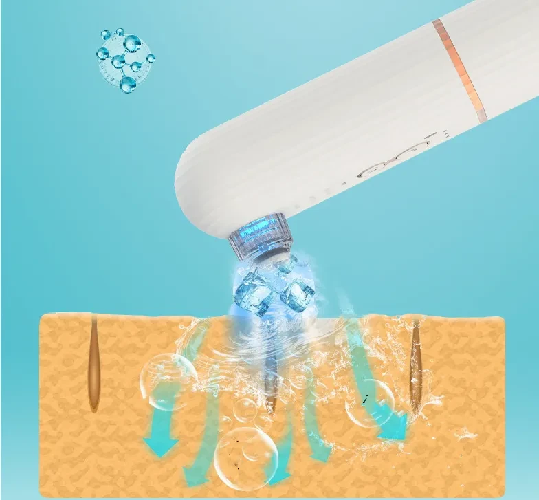 Dispositivo de succión de puntos negros con agua, oxígeno, hielo y calor, pequeñas burbujas