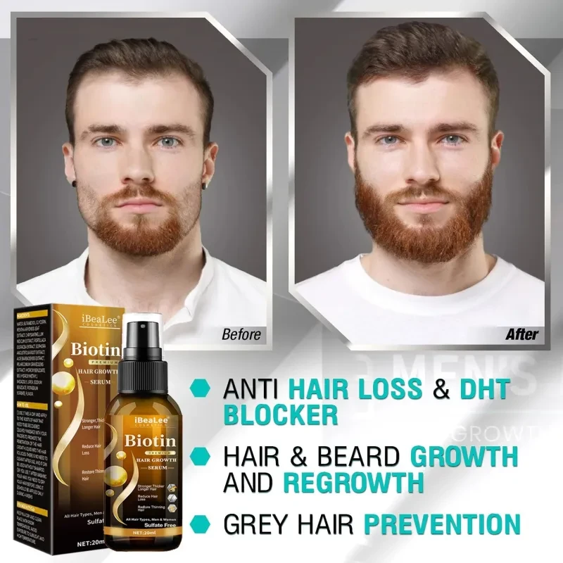 Líquido nutritivo anticaída para el cabello, reafirmante y potenciador del crecimiento del cabello.