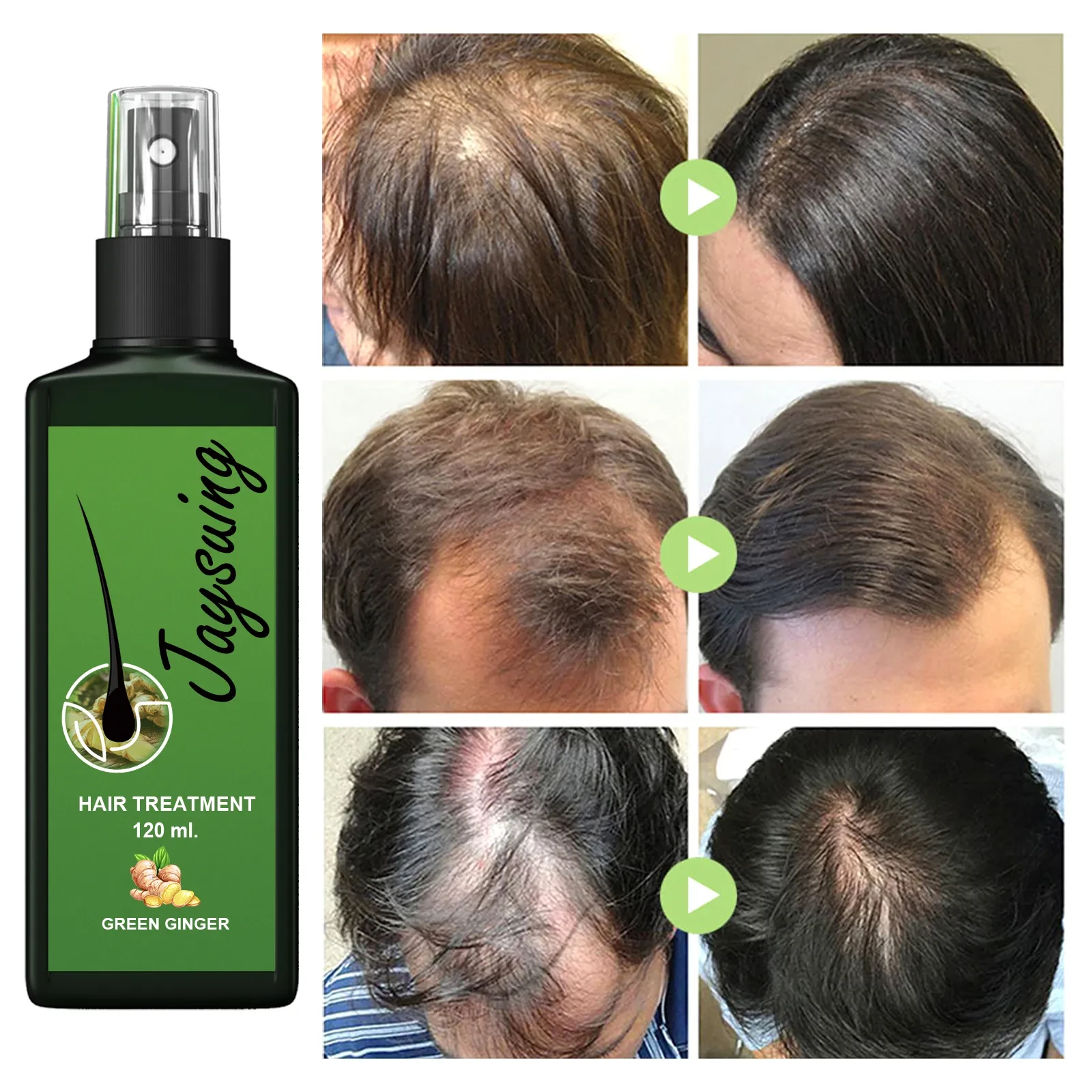 Tratamiento capilar Jaysuing: fortalece el cabello, nutre el crecimiento de las raíces y engrosa el cuero cabelludo. Solución nutritiva para masaje.
