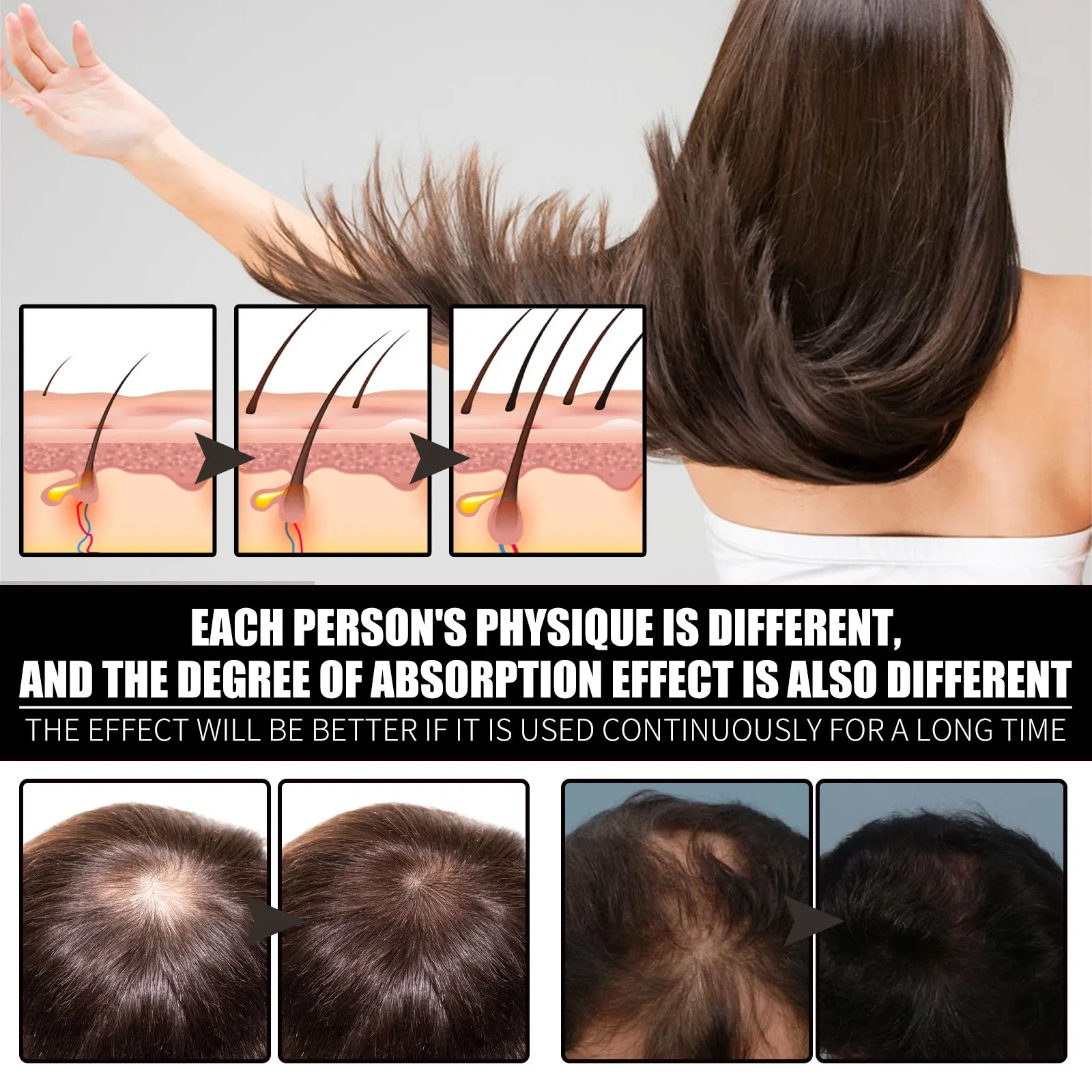 Gotas de biotina y colágeno líquido para el crecimiento del cabello - Suplemento de biotina y colágeno líquido para hombres y mujeres - Favorece una piel radiante y un crecimiento saludable del cabello y las uñas