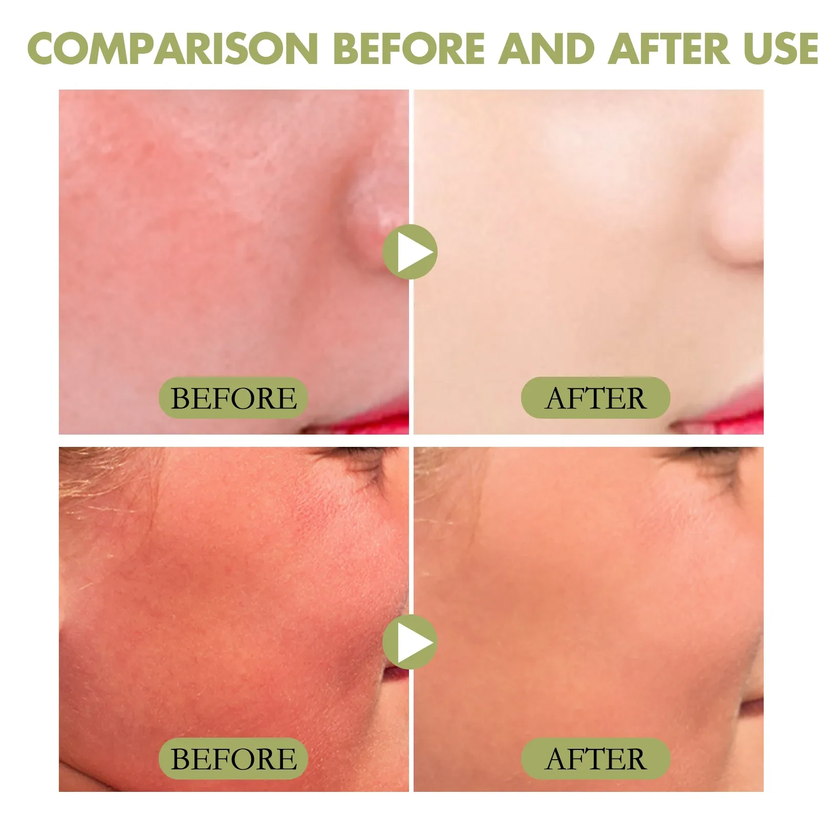 Crema protectora en barra que protege de los rayos UV, hidrata, repara e ilumina la piel. Crema refrescante para el cuidado de la piel.