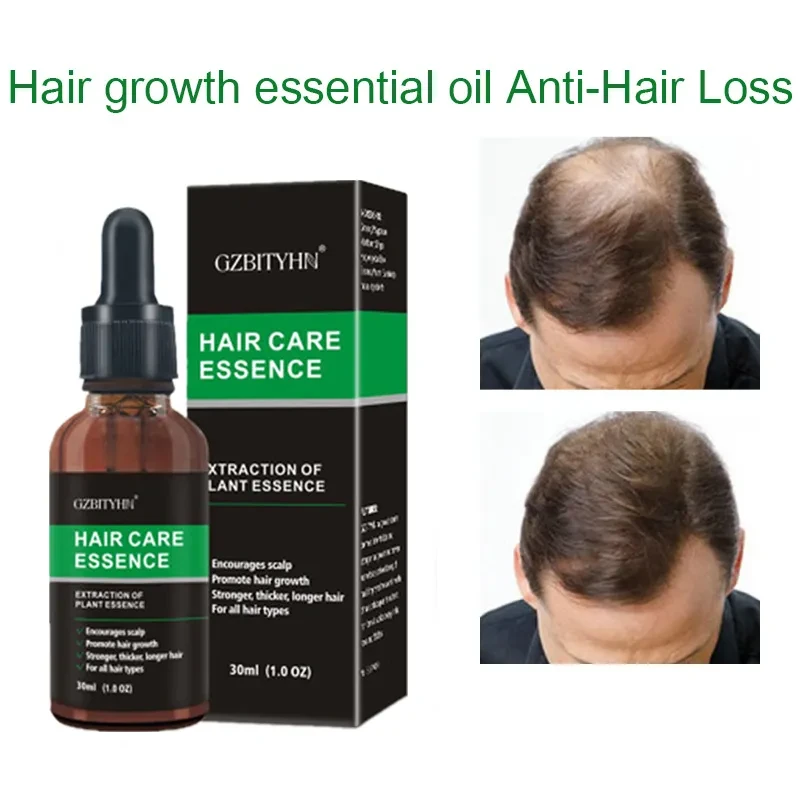 Aceite esencial para el cuidado del cabello OEM para un cabello más grueso y saludable