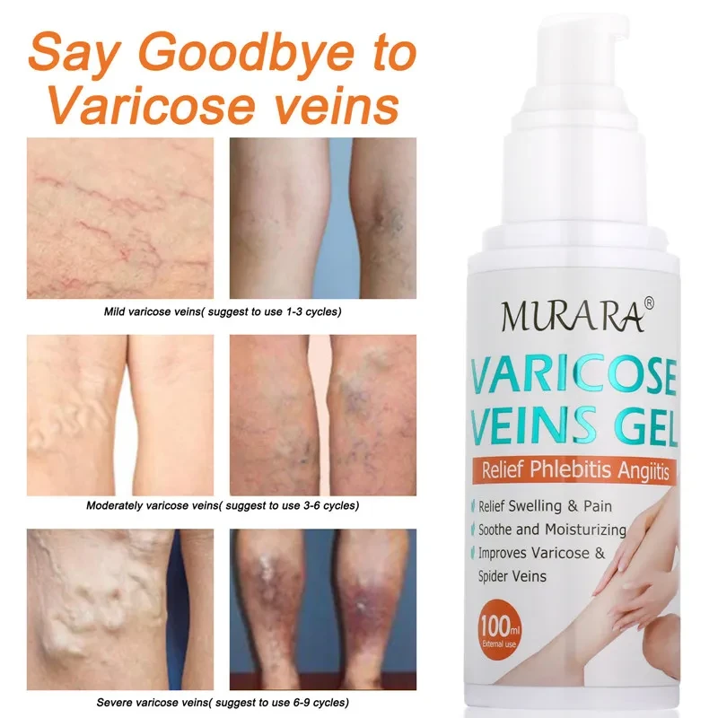 Crema en gel para venas, reparación y alivio de venas azules