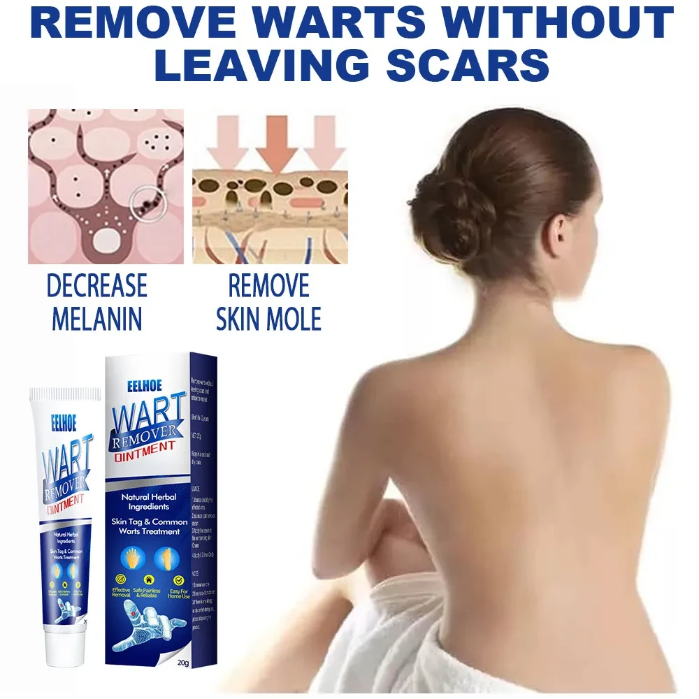 Loción para el cuidado de la piel común Liquid Skin Warts