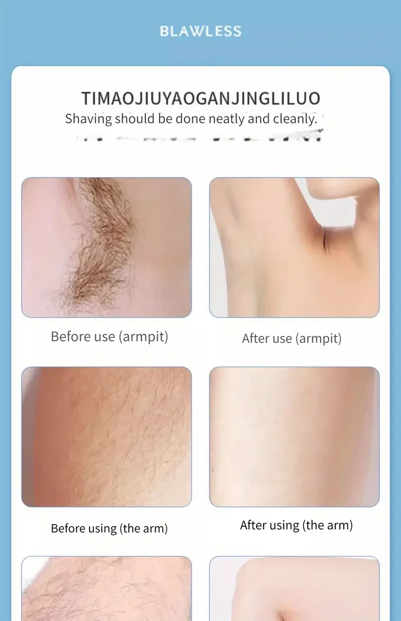 Kit de depilación de lujo 3 en 1 para mujeres: afeitadora eléctrica recargable para rostro, nariz y cuerpo completo. El regalo perfecto para mujeres con problemas de piel.