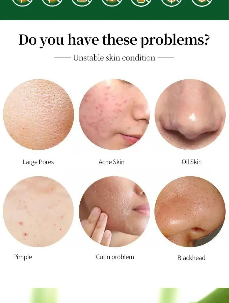 Solución hidratante para el cuidado facial con aloe