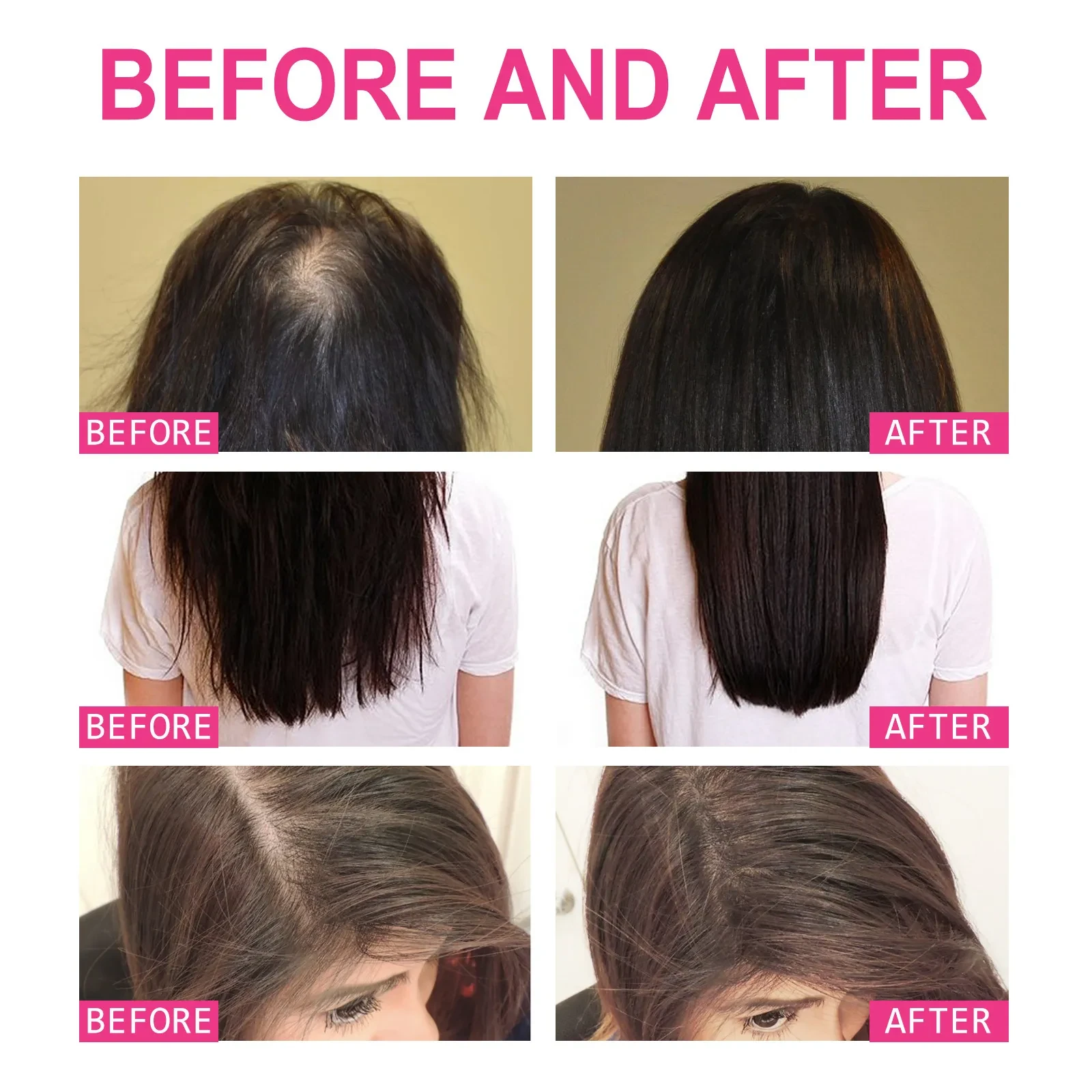 Aceite esencial hidratante y reparador para cabello seco y encrespado.