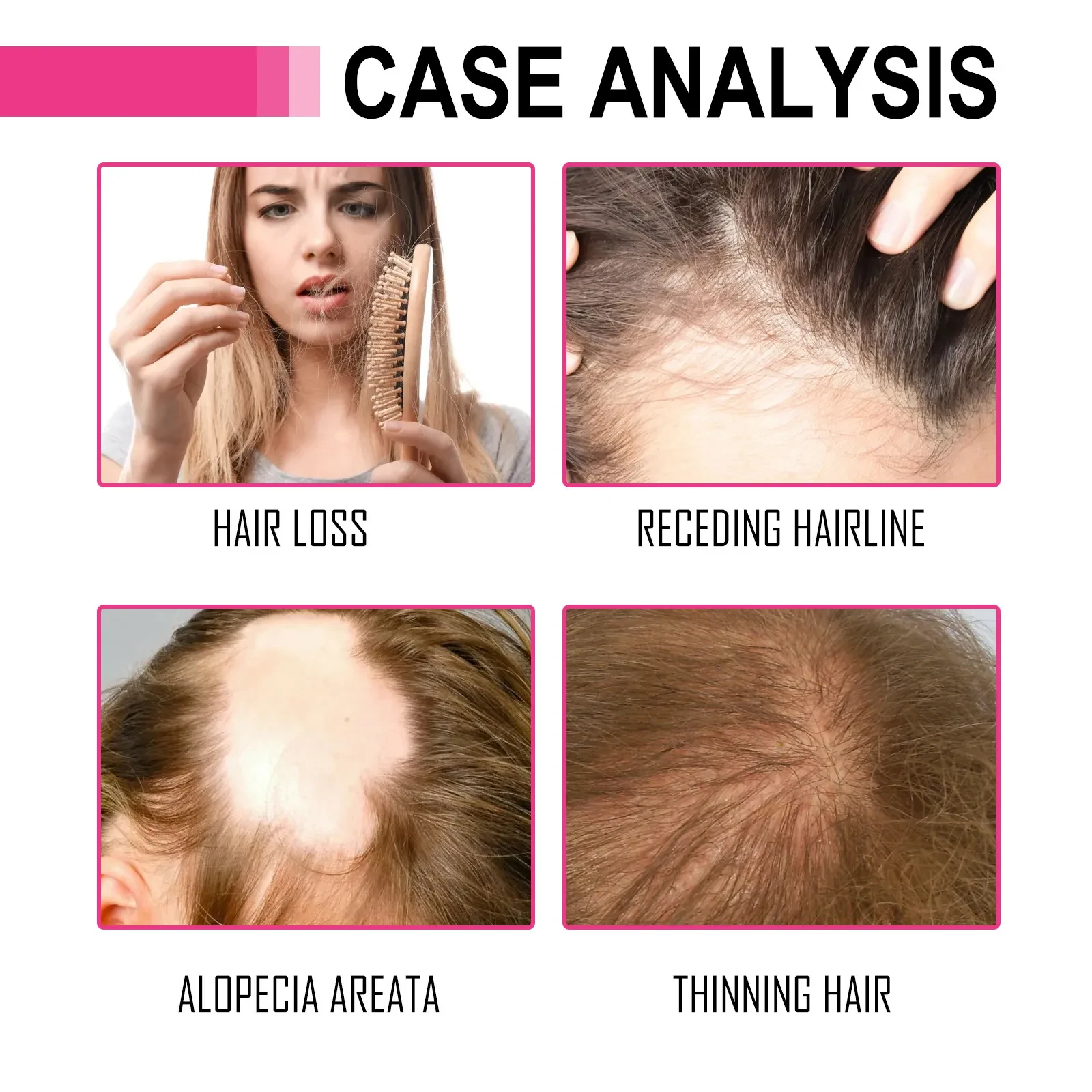 Aceite esencial hidratante y reparador para cabello seco y encrespado.