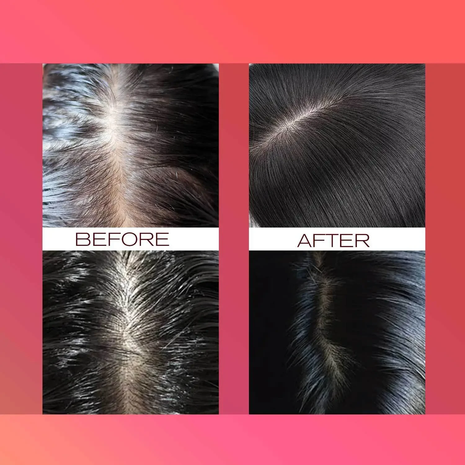 Aceite esencial para el cuidado del cabello Shuo Woxin Batana 30 ml