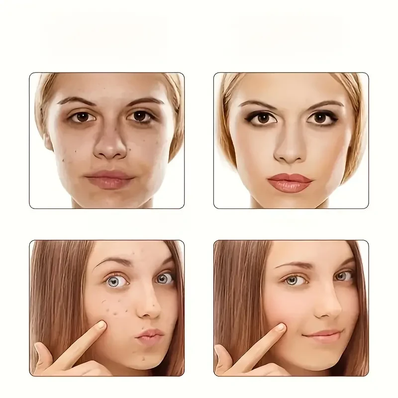 Crema para manchas de 30 g: hidratante facial para quemaduras solares, pecas, manchas de color, manchas de la edad y piel amarillenta. Desintegra la melanina y restaura una piel suave, radiante y con un tono uniforme.