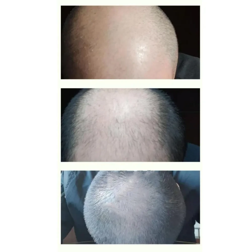 Champú anticaspa, reparador y nutritivo
