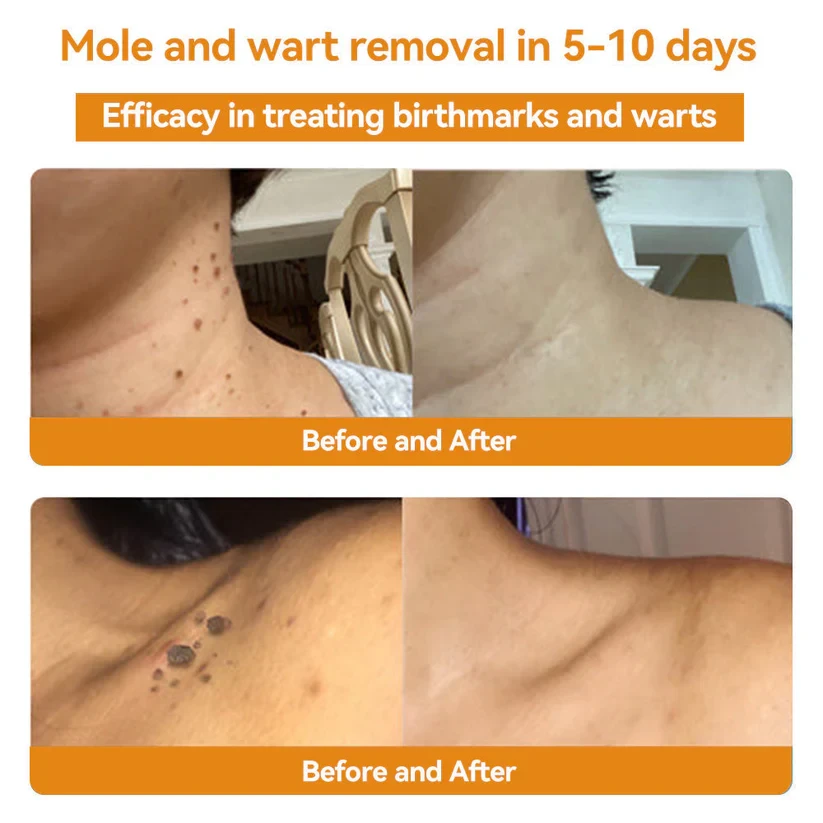 Crema para el tratamiento de la piel con veneno de abeja LOVILDS, aprobada por Health Canada