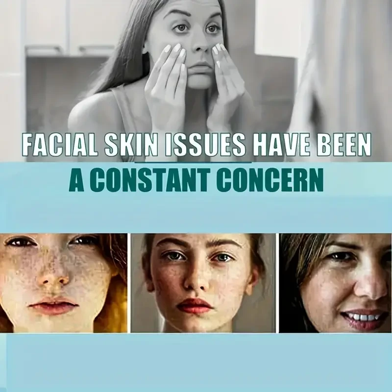 Eliminador de manchas oscuras hidratante para rostro y cuerpo: repara y suaviza la piel, no irrita, se absorbe fácilmente y no es graso. Perfecto para el cuidado de la piel.