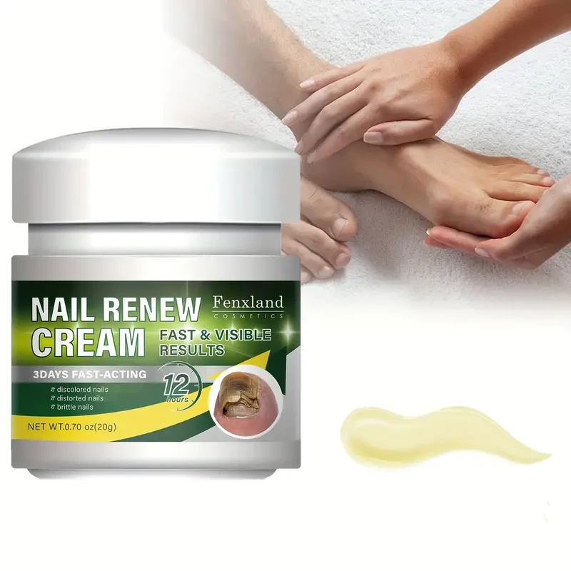 Crema renovadora de uñas Fenland 0.70 oz - Tratamiento de acción rápida para uñas descoloridas y dañadas, sin formaldehído, fortalece y mejora la condición de las uñas, crema para el cuidado de las uñas para hombres y mujeres