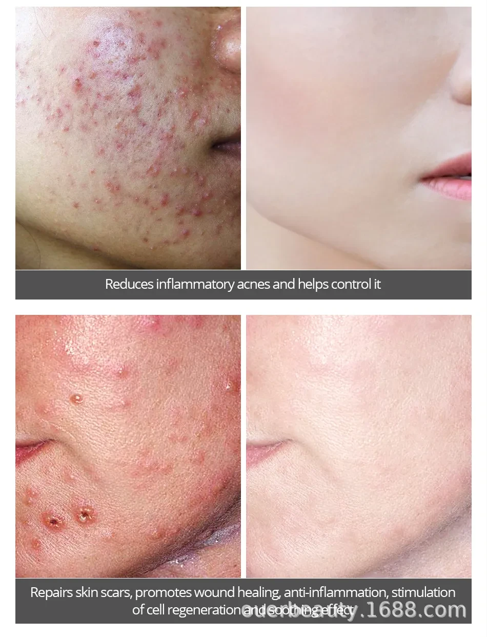 Set de cuidado reparador de caracol para el rostro