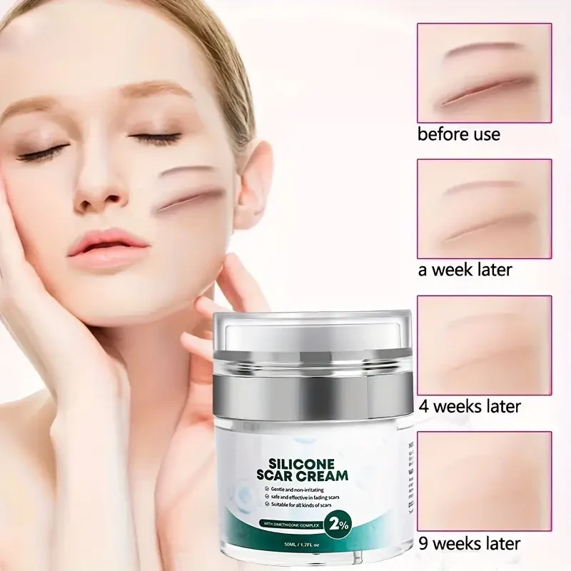 Gel para cicatrices: fórmula avanzada para atenuar cicatrices, cicatrices de acné, estrías y cicatrices quirúrgicas. Tratamiento reparador de la piel que contiene alantoína, vitamina E y gel de silicona. No graso y de rápida absorción.