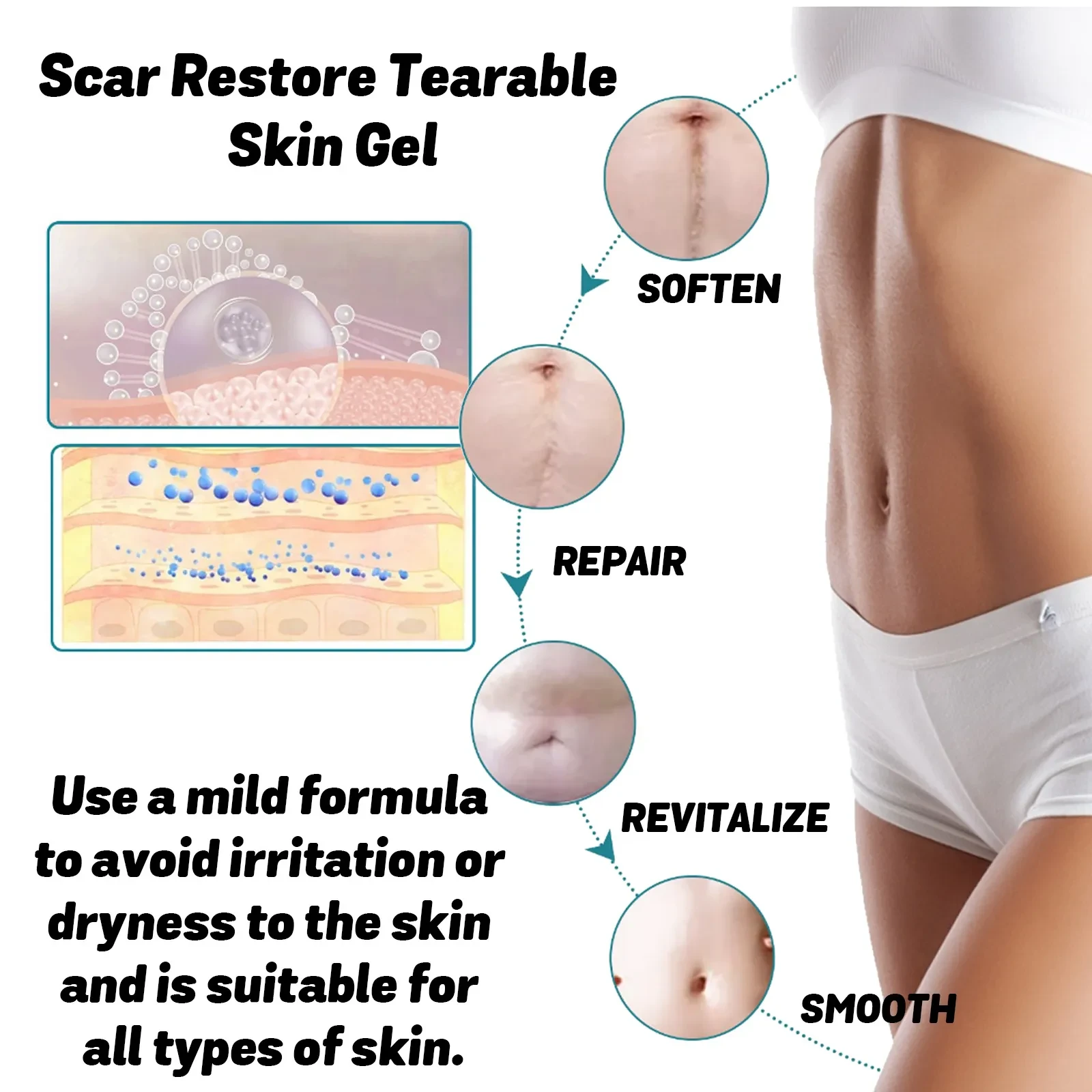 Gel para el cuidado de la piel que adelgaza las cicatrices