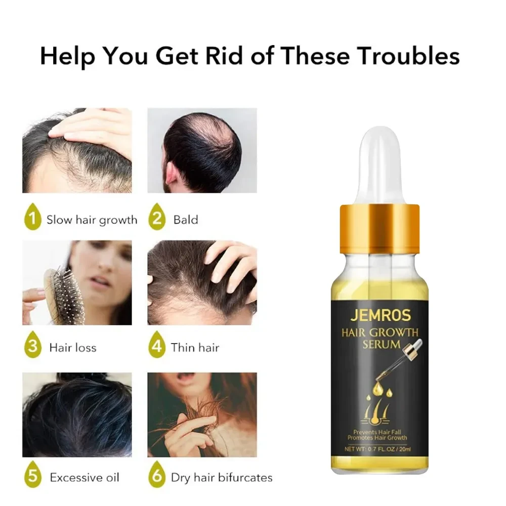 Aceites esenciales para el crecimiento del cabello Líquido para el crecimiento del cabello Aceites esenciales para el cuidado del cabello