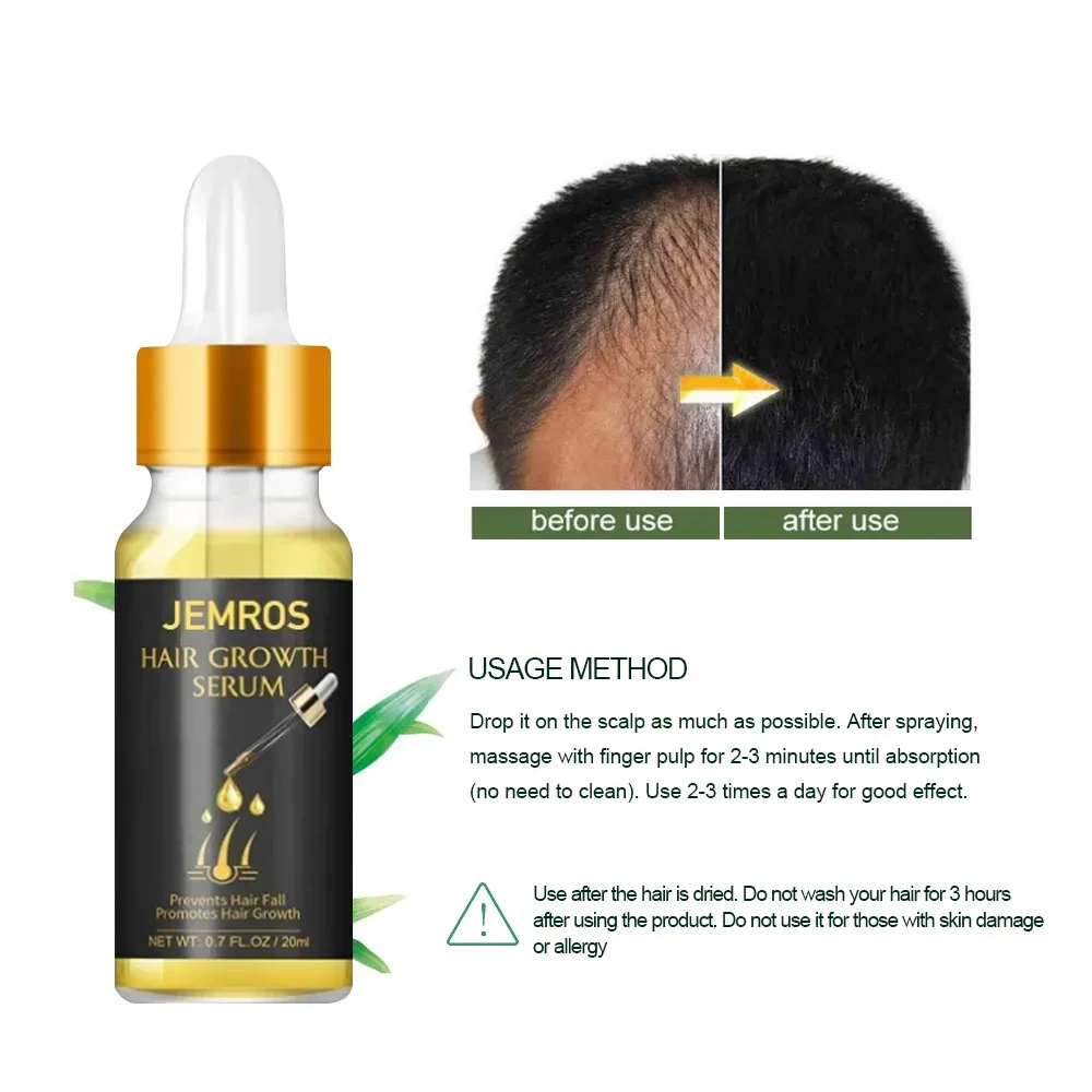 Aceites esenciales para el crecimiento del cabello Líquido para el crecimiento del cabello Aceites esenciales para el cuidado del cabello