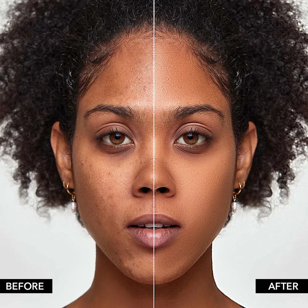 Fundación de cobertura total PHOFAY