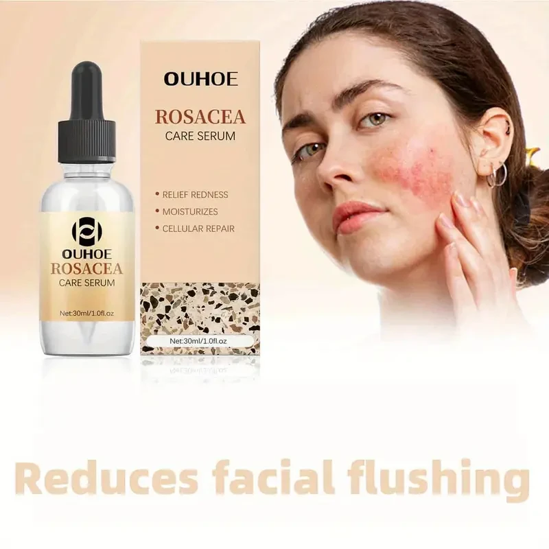 Suero para la rosácea OUHOE, 60 unidades, cuidado facial, aceites esenciales, hidrata y nutre, reduce el enrojecimiento de la piel, calma y elimina la piel escamosa, apto para todo tipo de piel, con glicerina, árbol de té, aloe vera y urea.