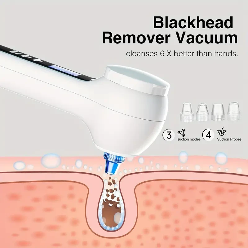 Sistema de limpieza facial recargable 3 en 1: exfoliante, masajeador y limpiador profundo de poros. Eliminador de puntos negros con aspiradora y exfoliante facial suave. Regalo perfecto para el Día de la Madre, ideal para todo tipo de piel.