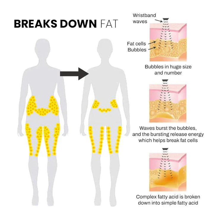 Pulsera ultrasónica moldeadora corporal Seurico Matteo Pro