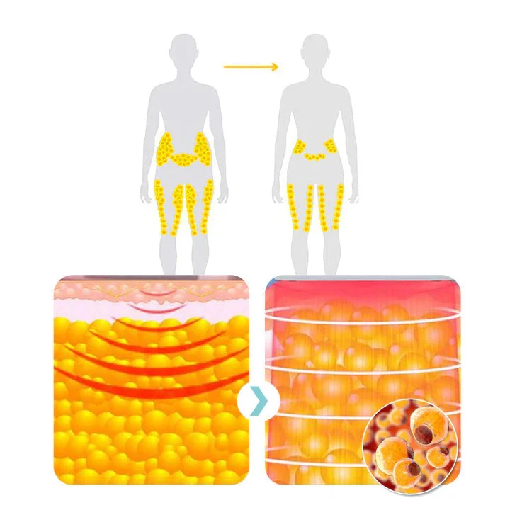 Pulsera ultrasónica moldeadora corporal Seurico Matteo Pro