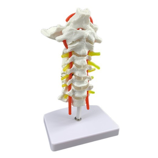 Modelo de espécimen de columna cervical humana con arteria carótida