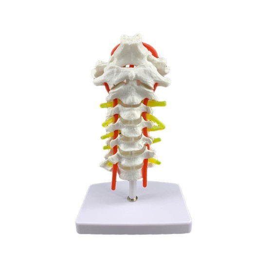 Modelo de espécimen de columna cervical humana con arteria carótida