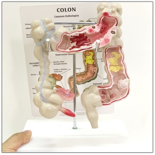 Modelo anatómico médico del intestino humano