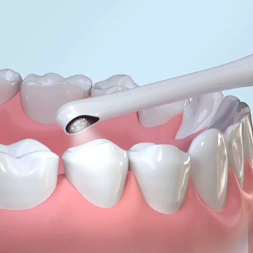 Espejo dental visual, endoscopio inteligente, toma fotos, herramienta de dentista, cámara HD 1080P, conexión Bluetooth.