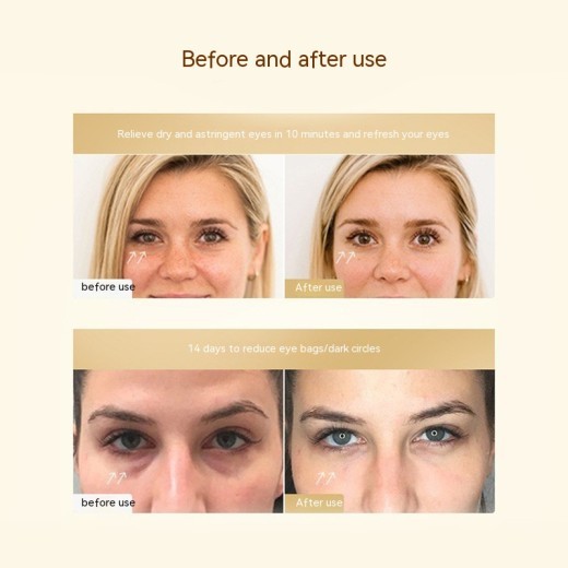 Almohadilla de gel de microcorriente para ojos, accesorios para instrumentos de belleza ocular