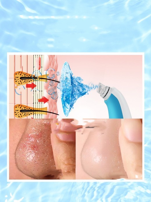 Limpiador de poros casero, pequeño limpiador de burbujas, instrumento de belleza