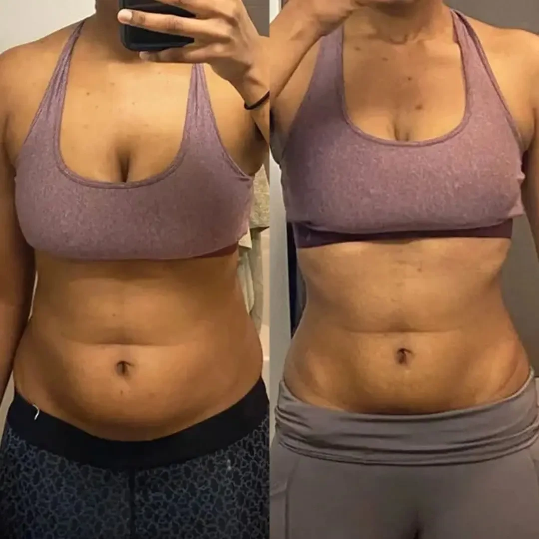 Cavitación ultrasónica Sonicfit