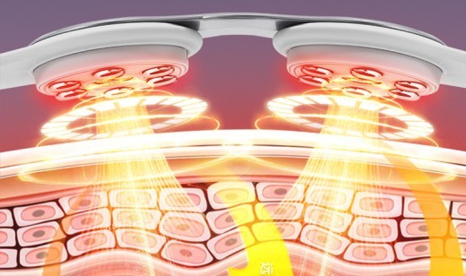 Cinturón de masaje lumbar infrarrojo lejano con control inteligente de temperatura