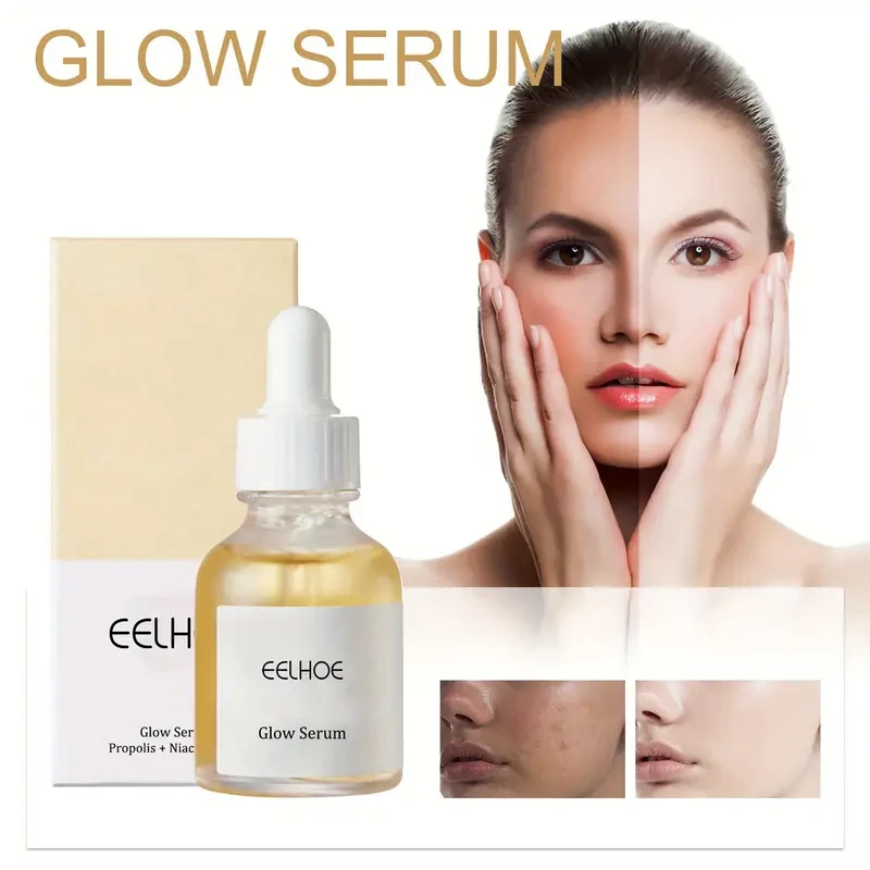 Eelhoe - Suero de niacinamida de 30 ml