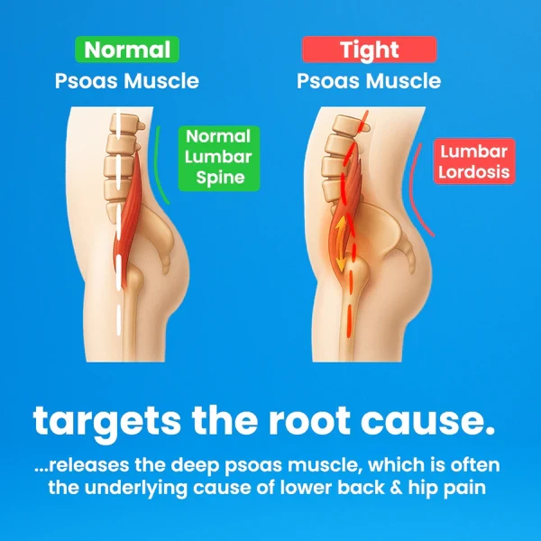 Capabody™ Psoas Peak