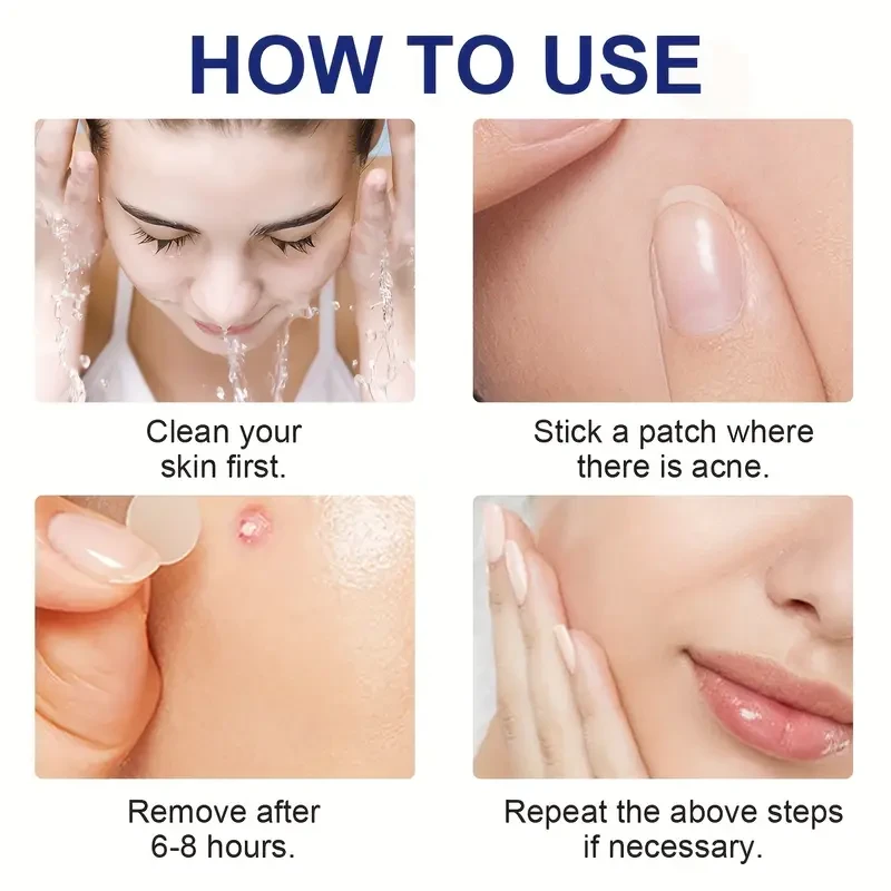 LANEMAY 78pcs Pimple Patch Set – Hydrocolloid Day & Night Acne Cover Patches