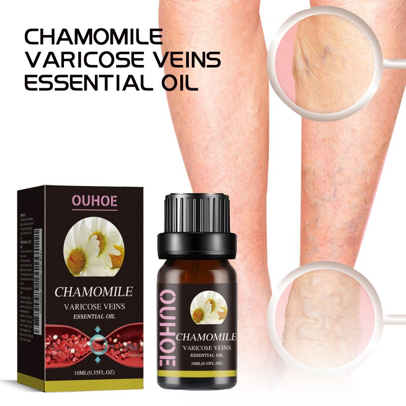Ouhoe Chamomile Varicose Veins Essential Oil – Natural Treatment for Smooth, Healthy Legs