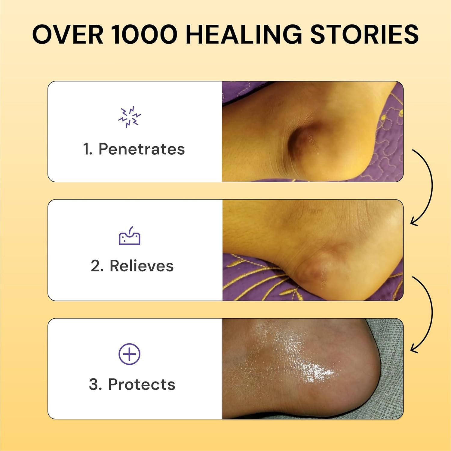 Universal Flare Care Muscle and Joint Pain Relief Cream