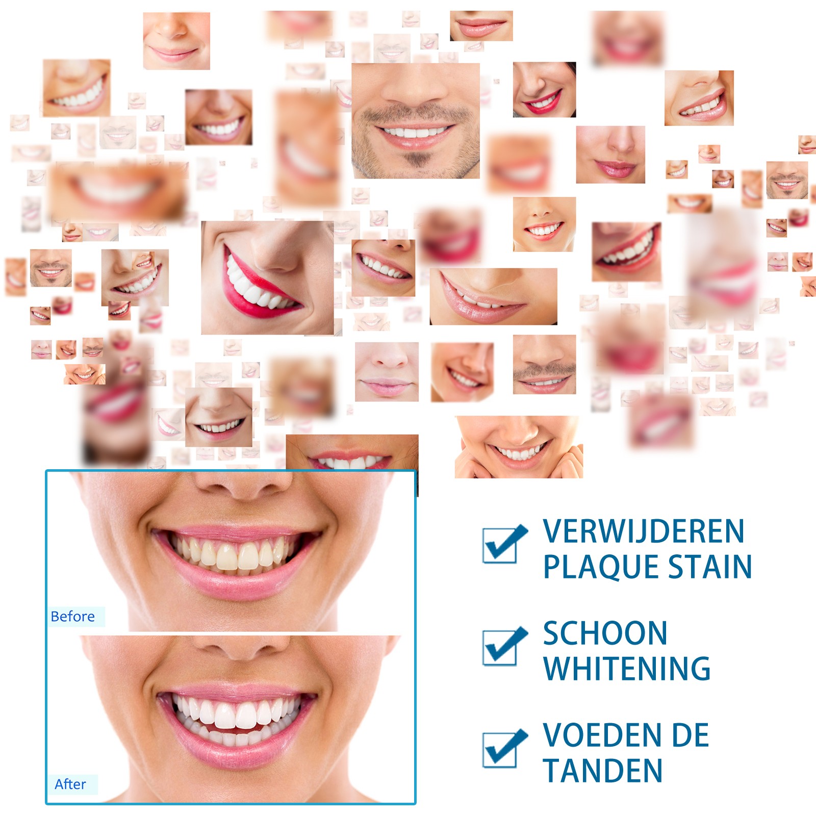 Jaysuing Teeth Whitening Tooth Brush – Instant Brightening Solution