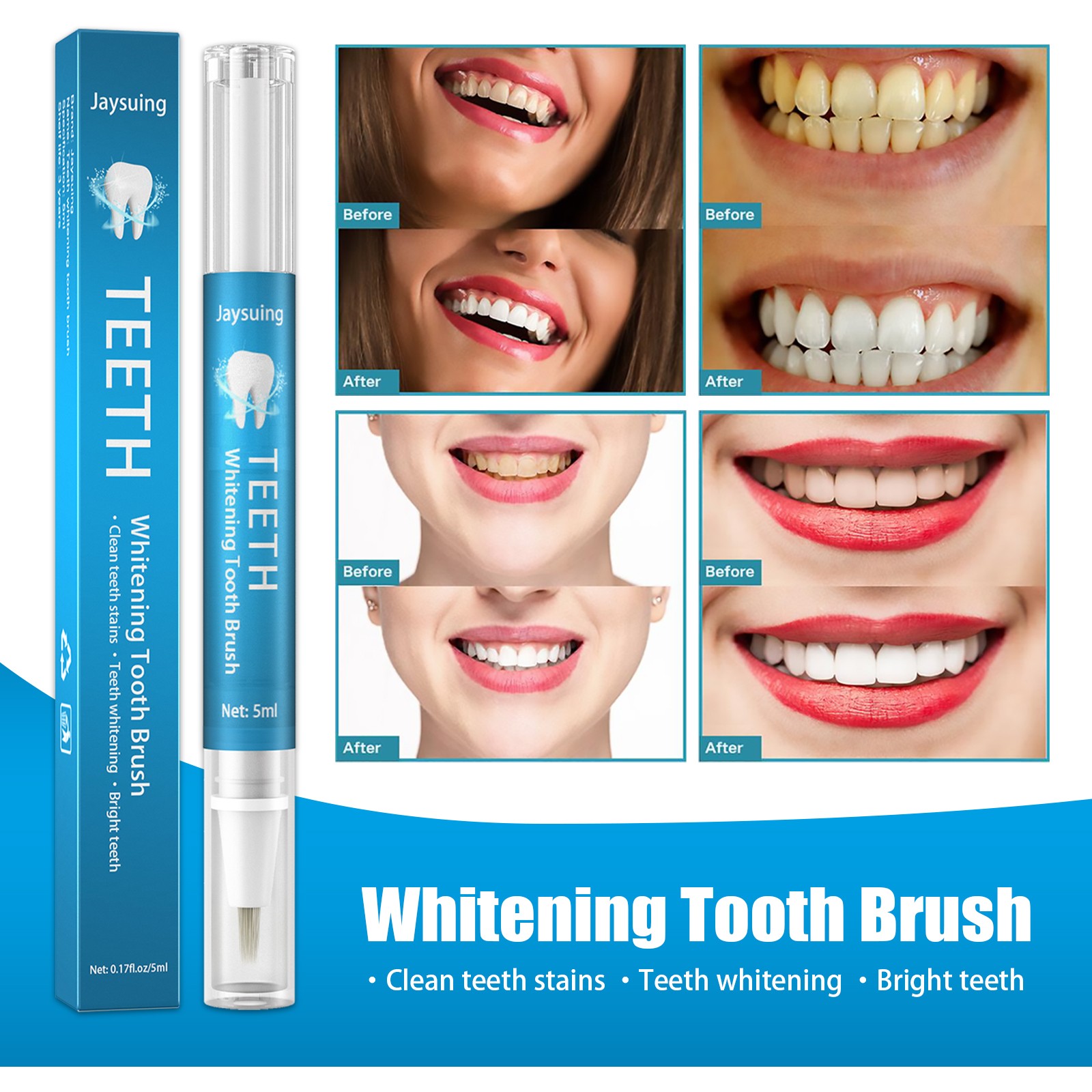 Jaysuing Teeth Whitening Tooth Brush – Instant Brightening Solution