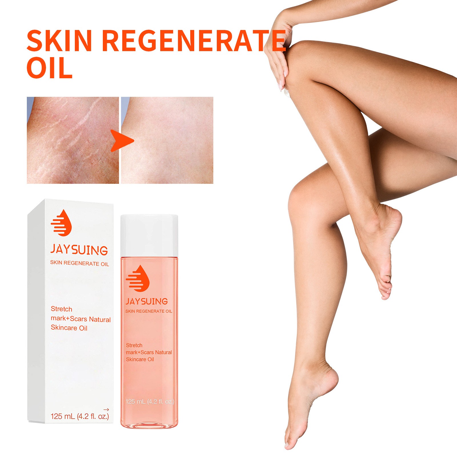Jaysuing Skin Regenerate Oil – Stretch Mark & Scar Treatment