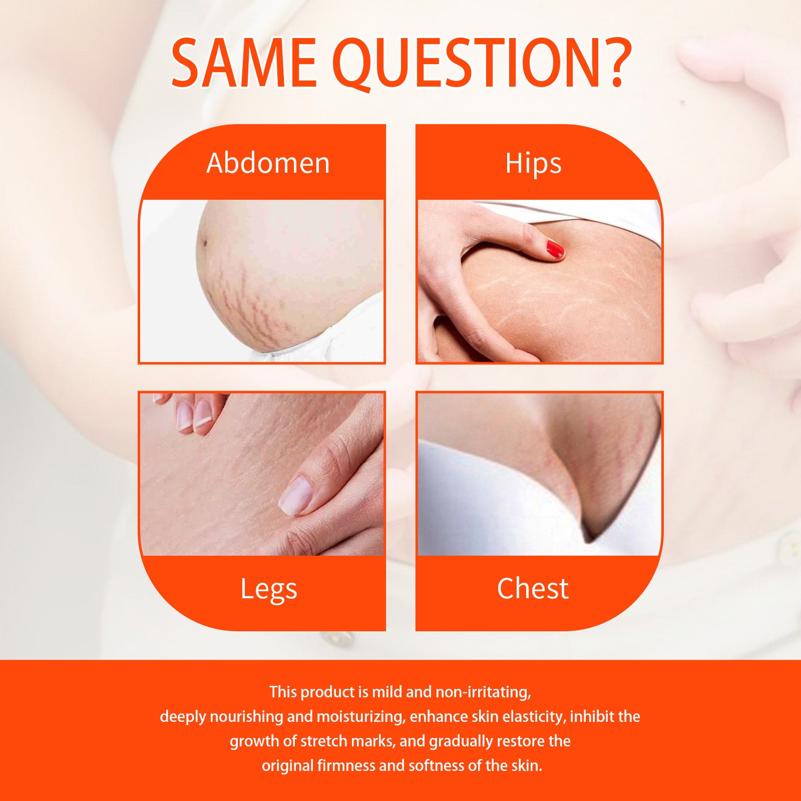 Jaysuing Skin Regenerate Oil – Stretch Mark & Scar Treatment