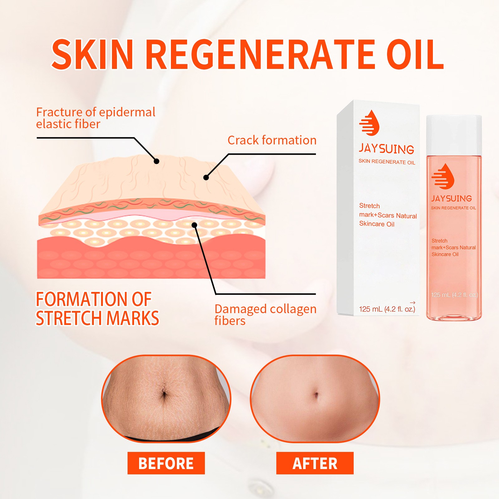 Jaysuing Skin Regenerate Oil – Stretch Mark & Scar Treatment