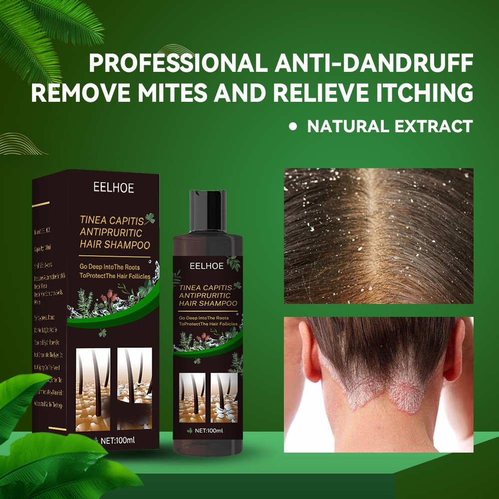 EELHOE Plant Formula Antipruritic Hair Shampoo – Dandruff Control & Hair Follicle Protection